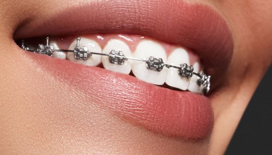 Ortodonti 